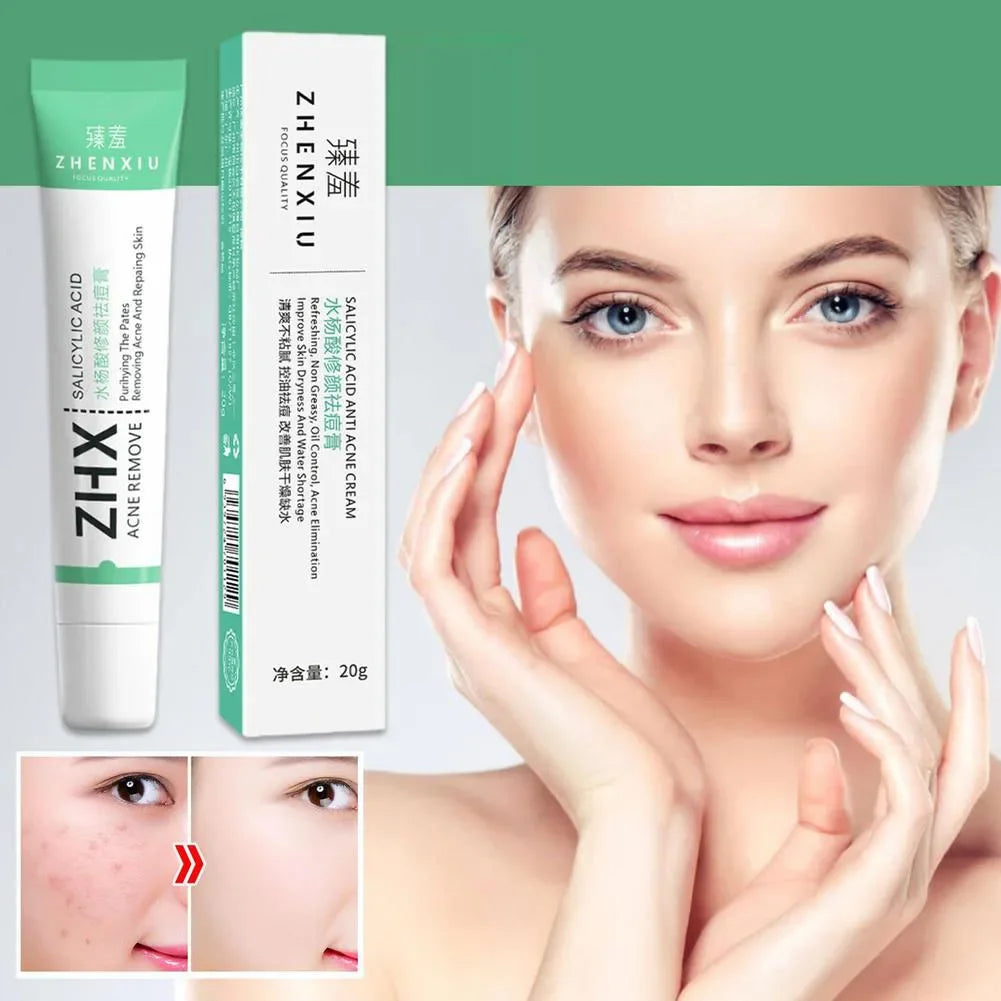 كريم حمض الساليسيليك للمسام - مزيل للرؤوس السوداء، ومُصَغِّر للمسام الكبيرة، ومُصَلِّح لبشرة الوجه (20 جم)