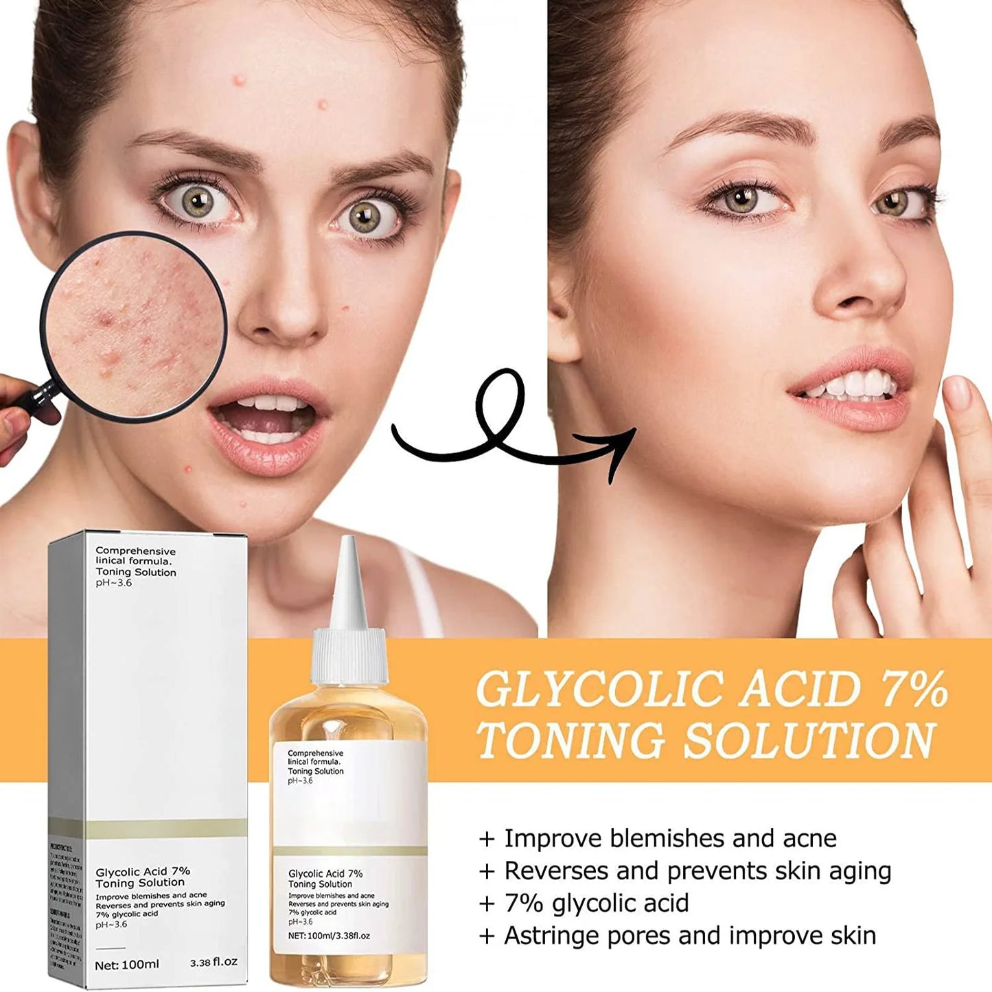 Glycolic Acid 7% Toning Solution – Exfoliating Toner for Acne Removal, Skin Renewal & Moisturizing Care
