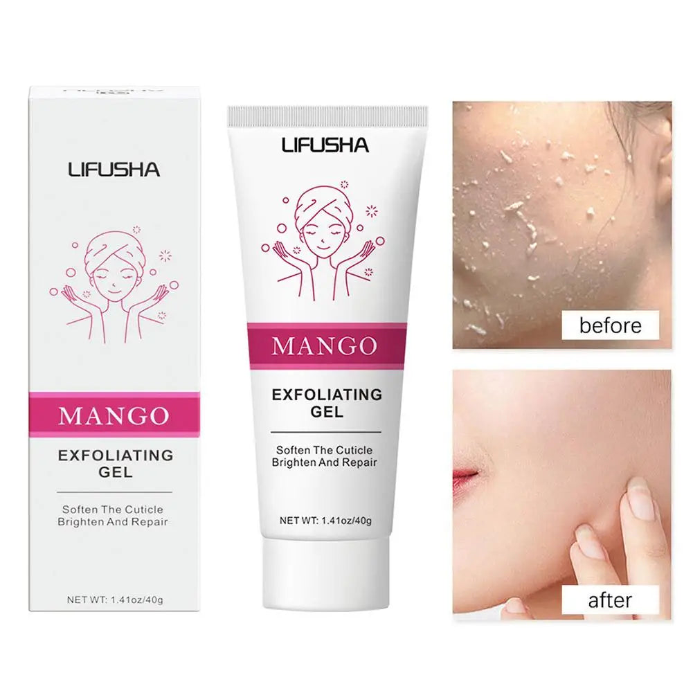 جل تقشير الوجه بخلاصة الصبار - مزيل للرؤوس السوداء، مقشر مرطب للوجه ومقلل للمسام (30-100 غرام)