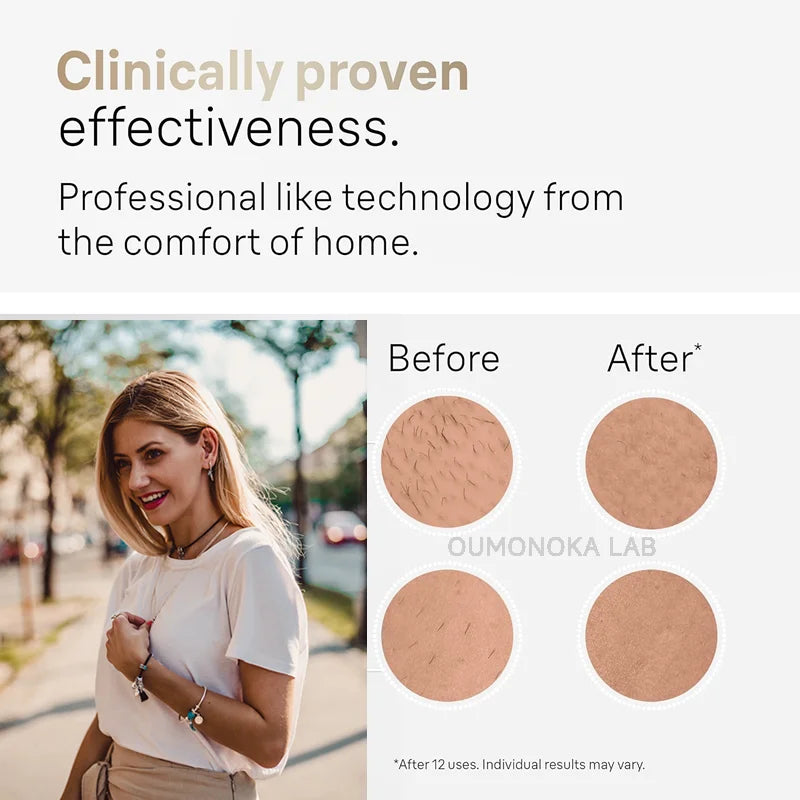 جهاز إزالة الشعر بالليزر IPL الجديد بـ 999,999 ومضة | جهاز إزالة الشعر الدائم للنساء والرجال