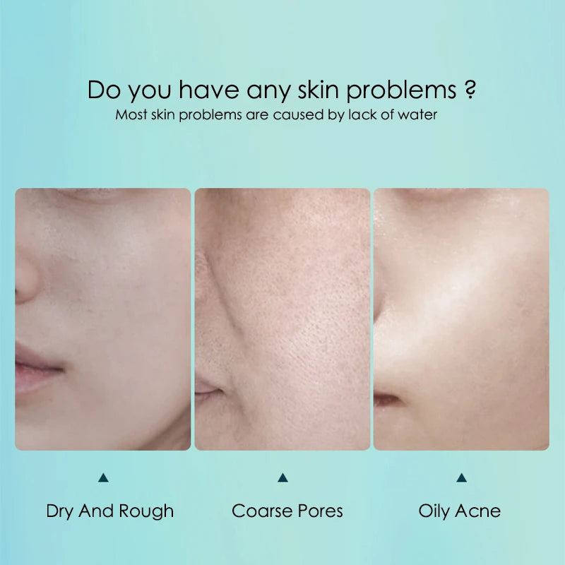 قناع الوجه بحمض الهيالورونيك - أقنعة ورقية مرطبة ومرطبة ومقلصة للمسام للوجه، 10 قطع