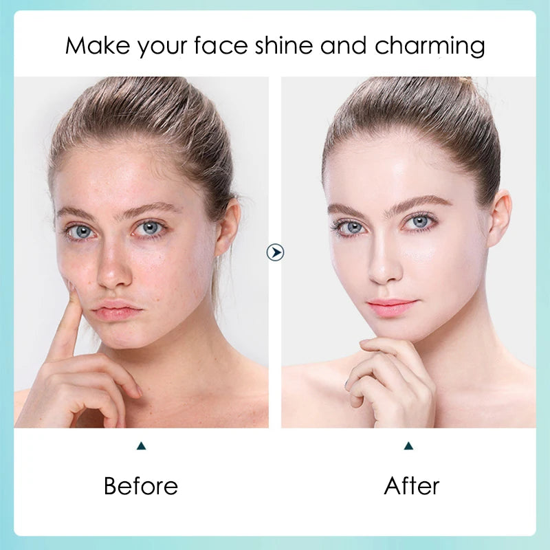 قناع الوجه بحمض الهيالورونيك - أقنعة ورقية مرطبة ومرطبة ومقلصة للمسام للوجه، 10 قطع