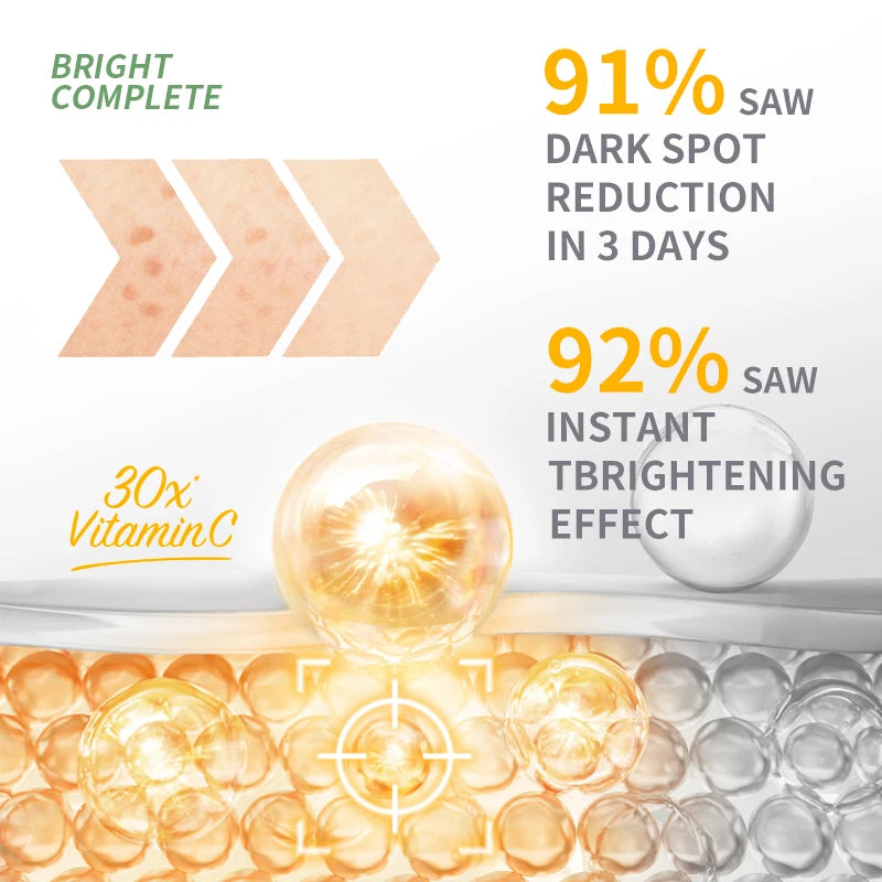 Garnier Bright Complete 30x Vitamin C Serum – Esencia potenciadora de niacinamida para aclarar el tono de la piel y atenuar las marcas de acné (30 ml)