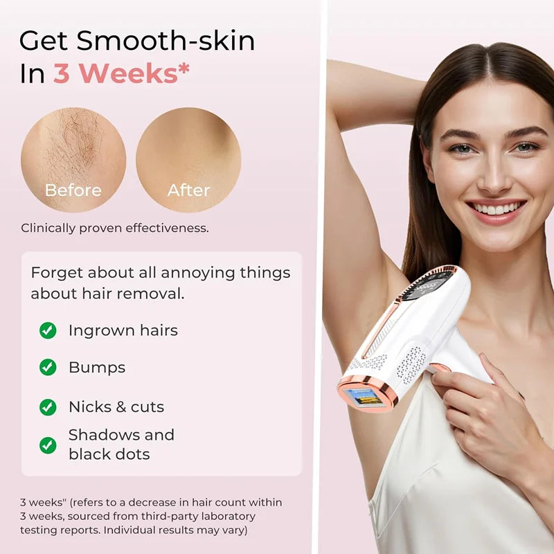 جهاز إزالة الشعر بالليزر IPL بـ 999999 ومضة - جهاز إزالة الشعر الكهربائي بدون ألم للنساء - للاستخدام المنزلي لإزالة الشعر بشكل دائم للبكيني والساقين والوجه